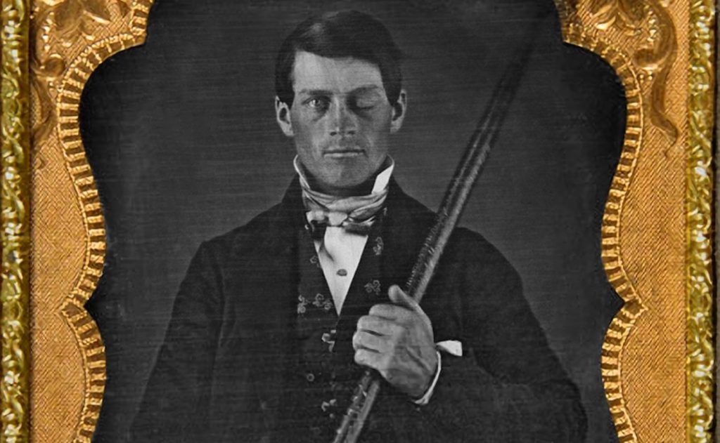 Phineas Gage sopravvisse alla ferita di un’asta che gli trapassò il cranio (Wikipedia)